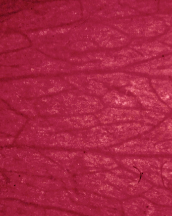 Deep hydration and  barrier repair