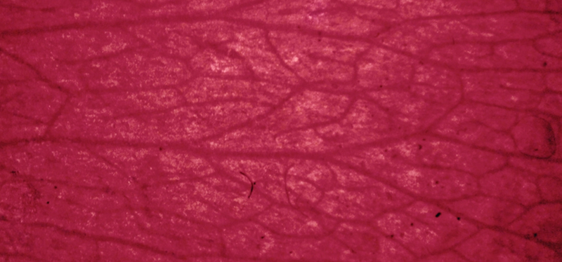 Stimulates tissue regeneration